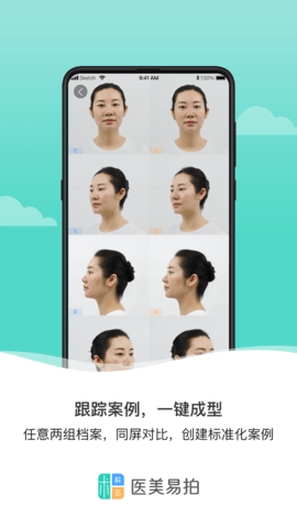医美易拍